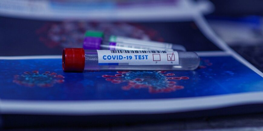 U Hrvatskoj se koristi najbolji test za dijagnostiku Covid-19